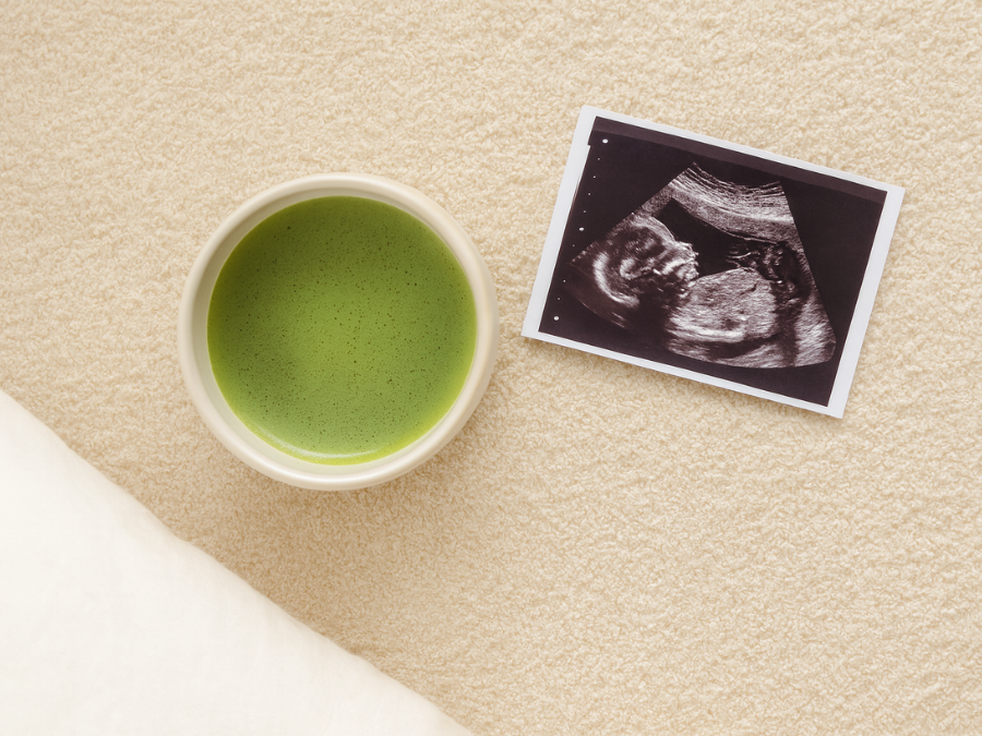 Matcha in der Schwangerschaft: Wie viel ist wirklich okay?